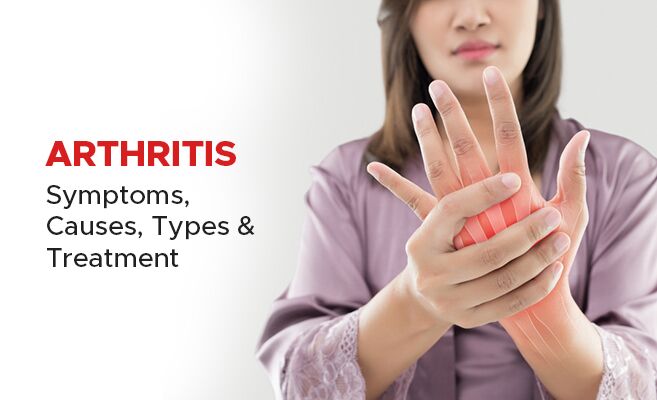 Arthritis: Symptoms, Causes, Types & Treatment